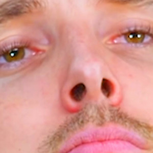 Cover: LazarBeam (UNOFFICIAL)